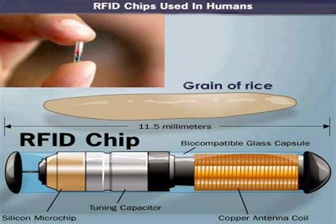 rfid chip under our skin by 2017|NBC Prediction That We Will All Have an RFID Chip Under Our .